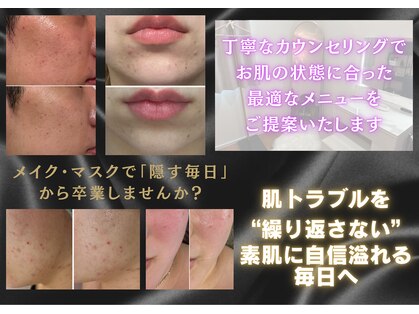 バルディーナ(BALDINA)の写真
