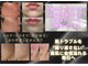 バルディーナ(BALDINA)の写真