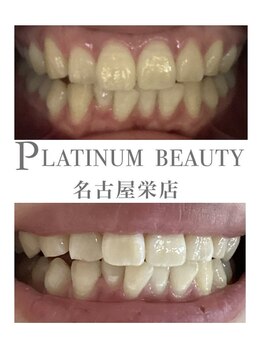 プラチナムビューティー 名古屋栄本店(PLATINUM BEAUTY)/お客様Before After