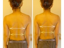 パル コルギサロン(Pal. Korugi salon)/コルギビフォーアフター