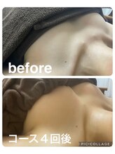 ギンザアール(GINZA R.)/バストアップ！