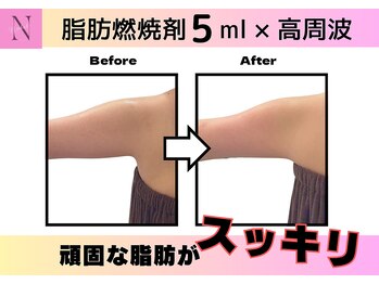 オーク ナチュリ 成城学園前(OAK×NACHUL)/お顔とボディの同時ケア可能