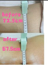 癒杏 高円寺/痩身上半身＆下半身集中ダイエッ