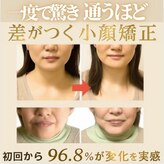 カオリン(顔凛)