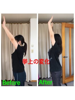 てんゆう整体/腕がスッと上がる