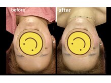 ラクーラビューティー(Lacu-ra Beauty)/