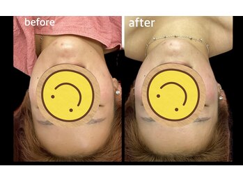 ラクーラビューティー(Lacu-ra Beauty)/