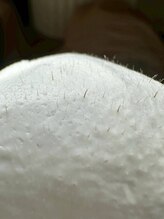 ウール 表参道(uur)/フェイスワックス/美肌/つや肌