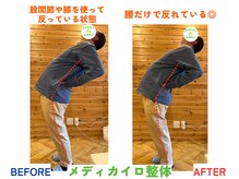 四条大宮アシスト鍼灸整骨院/全身整体ビフォーアフター