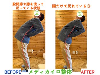 四条大宮アシスト鍼灸整骨院/全身整体ビフォーアフター