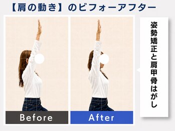 ウェルメディカル 豊中駅前整体院/整体×姿勢矯正【肩こり/腰痛】