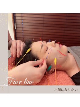 NANALA鍼灸　美容鍼×痩身強力もみだしマッサージの写真/《結果重視の造形級小顔》美容鍼（電気有無◎）×小顔矯正の高い技術でリピート間違いなし♪