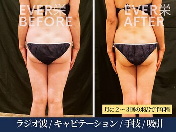 エヴァーグレース 宇都宮店/ 燃焼系BODY作りサポートします