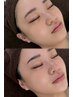 夏限定! Eyebrow + 鎮静・水分マスク