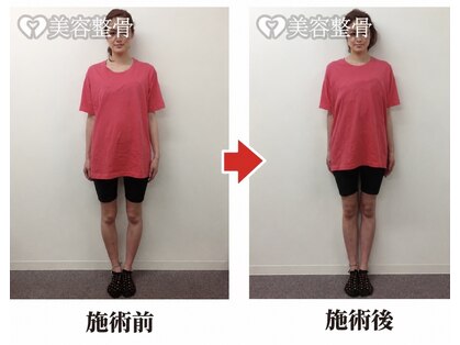 カモミール(Chamomile)の写真