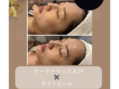リム ビューティー(RYM BEAUTY)の写真