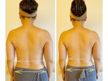 パル コルギサロン(Pal. Korugi salon)/コルギビフォーアフター