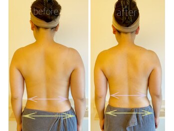 パル コルギサロン(Pal. Korugi salon)/コルギビフォーアフター