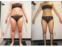 クイーン 札幌駅前店(Queen)/お客様　ビフォーアフター（26）