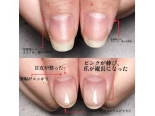 美（chura）は爪のお悩みを改善しながら美爪へと導きます