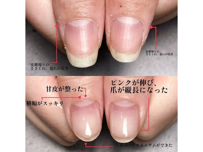 美（chura）は爪のお悩みを改善しながら美爪へと導きます