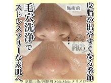 メリメロ(Meli-Melo)の雰囲気（クリニックでも改善できなかった毛穴悩み、自信の持てる素肌へ◎）