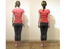 松山美容整体院/（４０歳代）　施術例