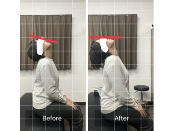 ナオル整体 平塚院(NAORU整体)/首の動きで頭痛を改善!!