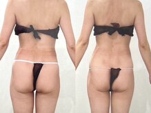 エレニア 住吉店(Elenear)/よもぎ蒸し×リンパマッサージ