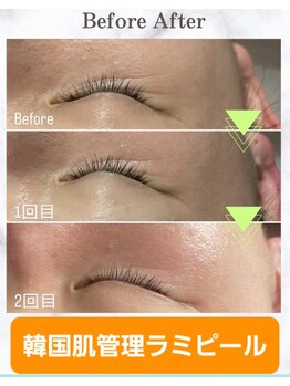 スリーム(S-urimu)/ラミピール正規導入店☆