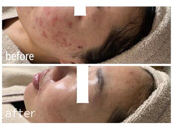 ラポール 野並店(Rapport)/