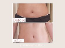 トータルビューティー ゆみえエステ(Total Beauty)/痩身