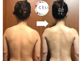 ヴァン ベール 那覇店/デコルテ背中ケア