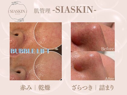 シアスキン(SIASKIN)の写真