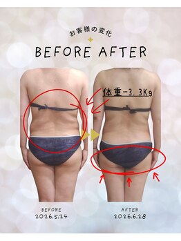 ツルとフクロウ(TSURUFUKU)の写真/原因溜め込む身体を本気で変えたい！脂肪燃焼×代謝upと痩身で理想の私へ★