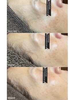 サロン フェリシア(salon Felicia)の写真/シミシワ改善はプロにお任せ！40代以上の自分ではなかなか改善できないと感じるお悩みを全力でサポート◎