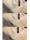 サロン フェリシア(salon Felicia)の写真/シミシワ改善はプロにお任せ！40代以上の自分ではなかなか改善できないと感じるお悩みを全力でサポート◎