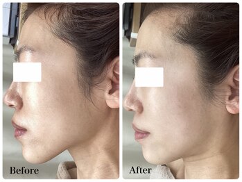 ルピア(L'pur)/骨格ケア♪