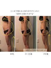 グレッセン(glanzen)/希望が叶う！すっきりラインへ♪