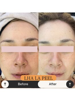 ルームエイトエイティスリー 新宿(R883)/ララピール　before→after