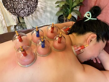 リラクゼーション アーラ(Ala)/カッピング (吸い玉)