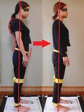 チャラク(charaku)/【30代H様：猫背+反り腰姿勢】