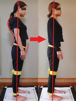 チャラク(charaku)/【30代H様：猫背+反り腰姿勢】