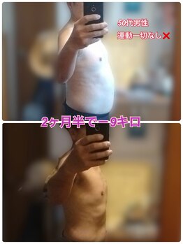 フォルトゥナサロンの写真/運動なしでここまで痩せる！！夏までに痩せたい方必見◎産後太りも◎