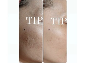 ソランザサロン(Solan the salon)/圧倒的なハリツヤ実感