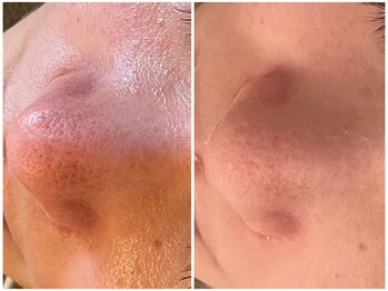 レスイズモア 恵比寿(less is more.)/1回の変化[はちみつパック付]