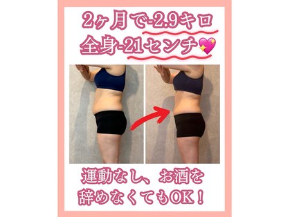 エミィシア(Emisia)の写真