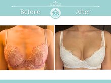 美人バスト 表参道店/【バストアップ/育乳 症例】