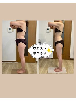 ココロミ(cocoromi)/ハイパーナイフ