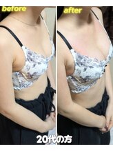 スノードロップ(snowdrop)/バストケア[１回でのバストUP]